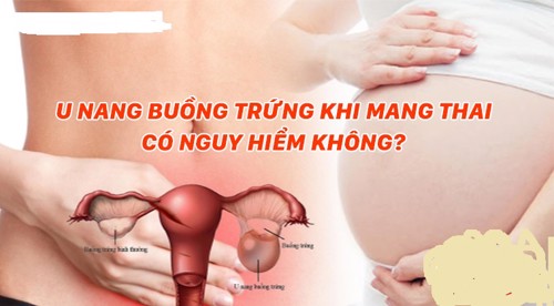 U nang buồng trứng khi mang thai có nguy hiểm không?